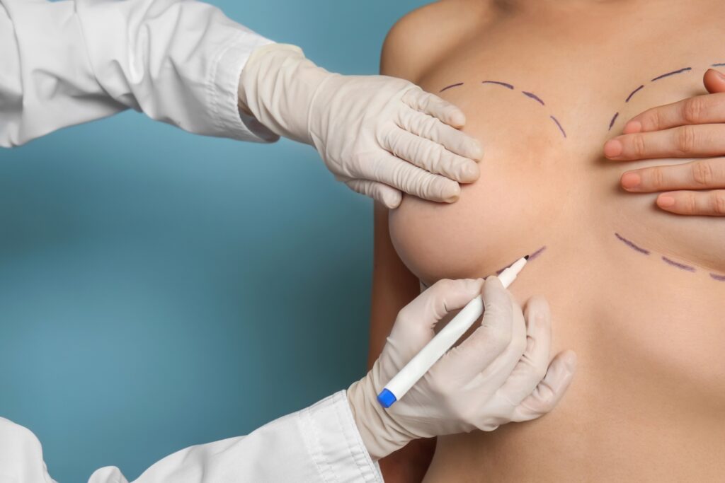 Cosmetic Breast Surgery in Turkey