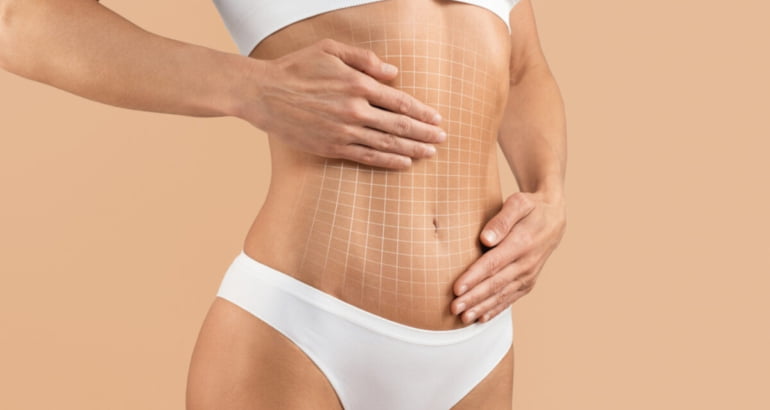 Tummy Tuck in Turkey