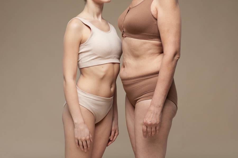 How long does it take to heal from a mommy makeover?