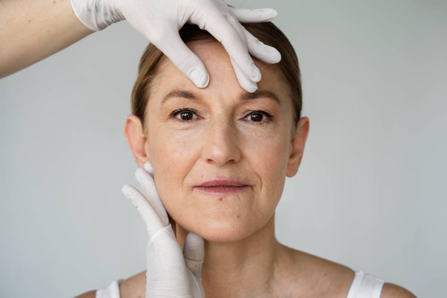 How long do face lifts last?