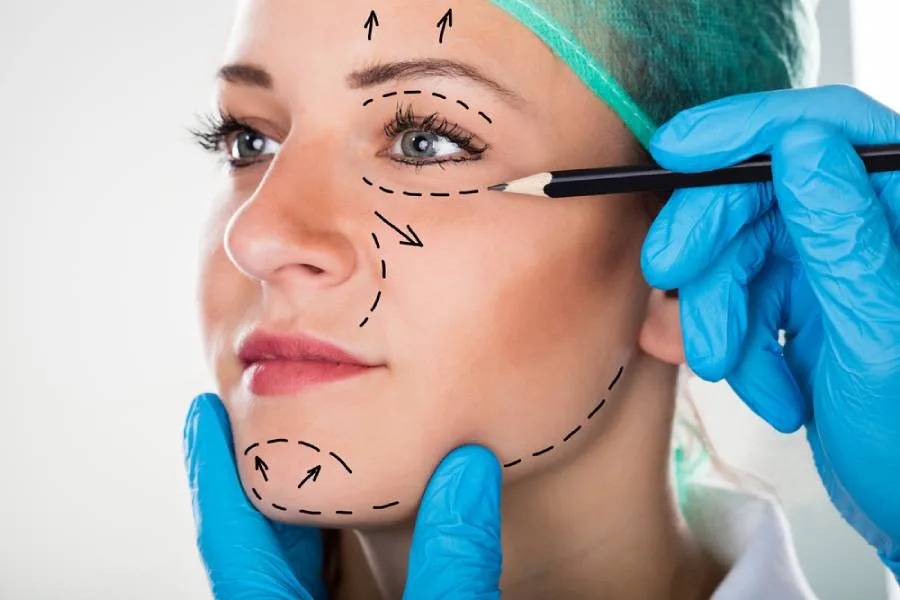 How should i prepare for cheek lift in turkey?