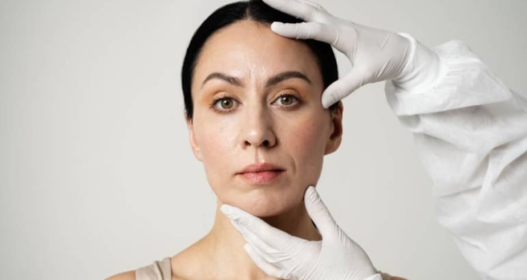 How long do the effects of a face lift last?