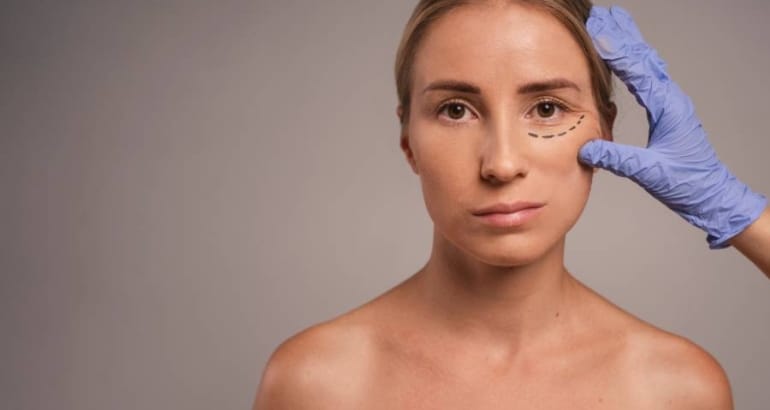 What is a deep plane face and neck lift?