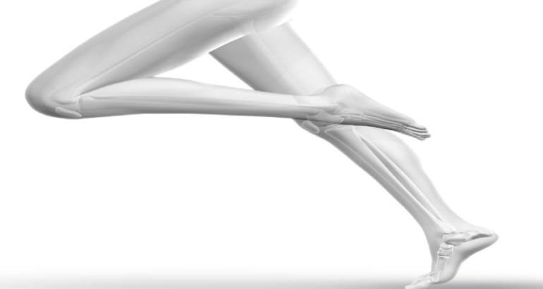 How long do calf implants last?