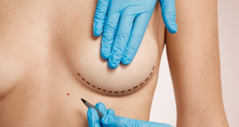 Tuberous Breast and Breast Asymmetry: Can They Be Corrected at the Same Time?