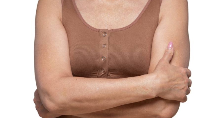 Breast Surgery Scars: Placement and Healing Process