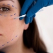 Combination Facial Surgeries: Facelift + Eyelid Surgery
