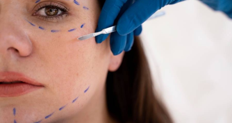 Combination Facial Surgeries: Facelift + Eyelid Surgery