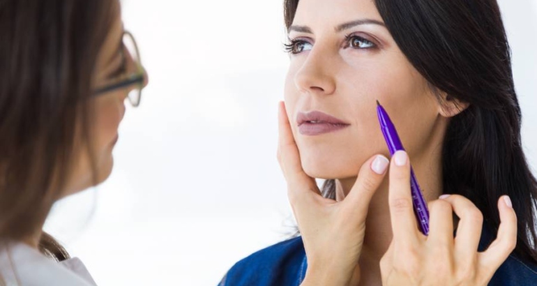 Deep Plane Facelift Recovery Timeline: What to Expect Day by Day