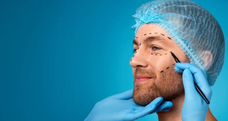 How Modern Facelift Surgery Creates Natural Results Without the “Pulled” Look