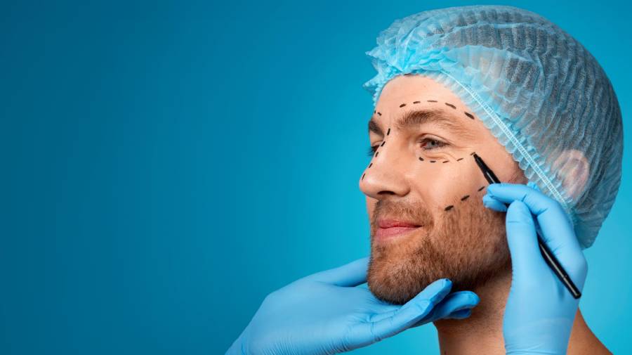 How Modern Facelift Surgery Creates Natural Results Without the “Pulled” Look