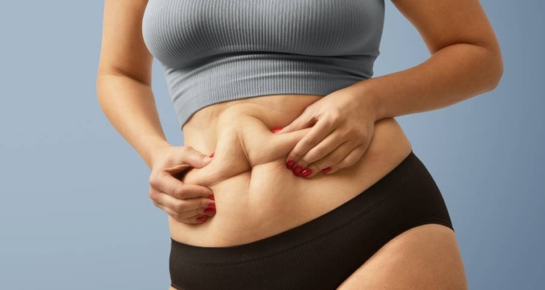 How Surgeons Create a Natural Waistline During Tummy Tuck Surgery